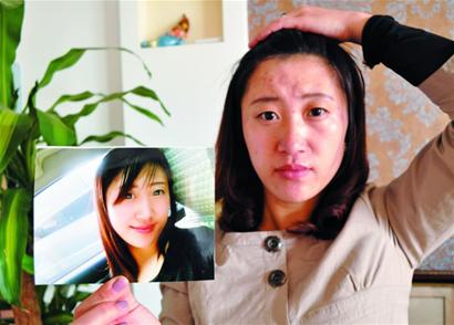 青島女子為聚財(cái)太陽穴打萬元美容針 流膿浮腫險(xiǎn)毀容